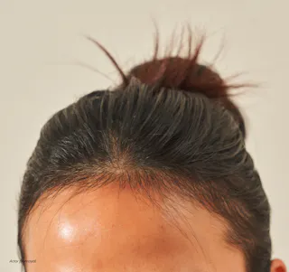 Close-up of the top of a person's head with dark hair in a bun, suggesting healthy growth possibly attributed to the use of Tretinoin Cream, against a neutral background.