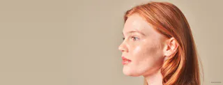A profile of a person with red hair and fair skin glances to the right against a plain background, embodying the fresh radiance often associated with Tretinoin Cream.