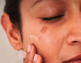 Women applying a topical gel to her face